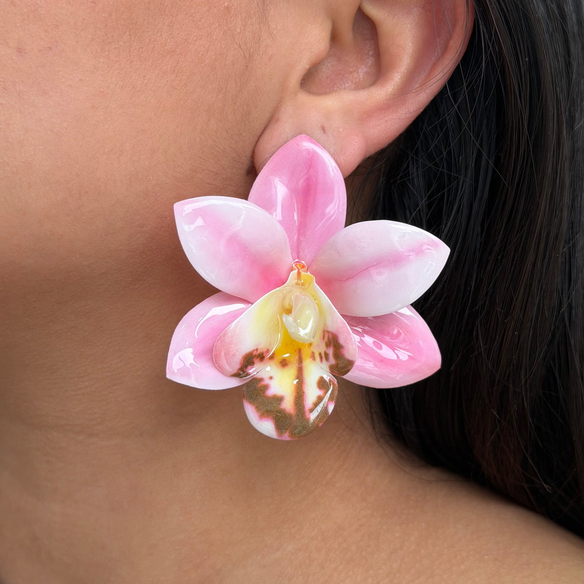 Arete Orquídea
